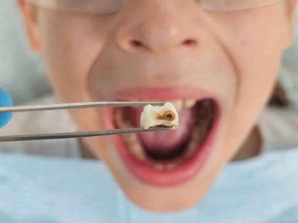Best Affordable Emergency Dental Care  in Falls City, NE
